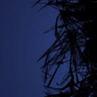 双侧输卵管不通如何怀孕